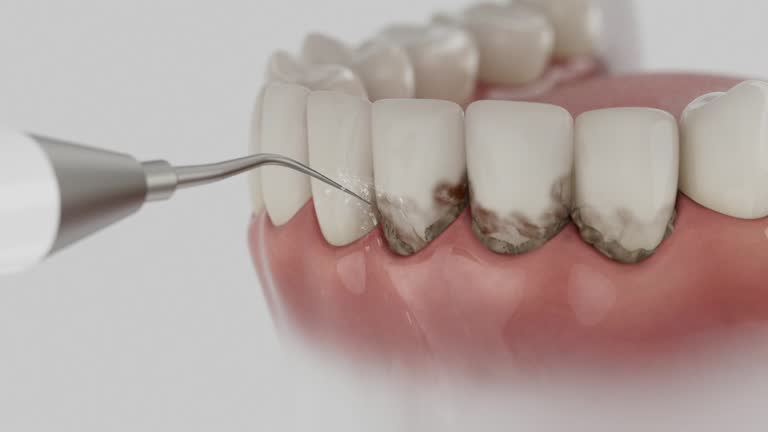 Reliable Dental contractor in Clayton, IN by Dentist Open Now
